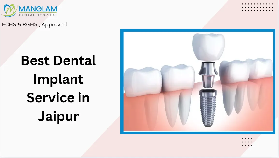 Dental Implant Service in Jaipur with rghs